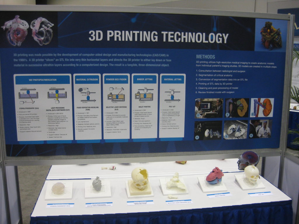 RSNA 3D Printing Technology