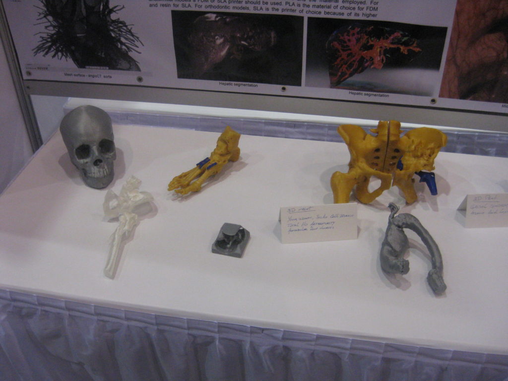 RSNA 2019 3D Printed Models