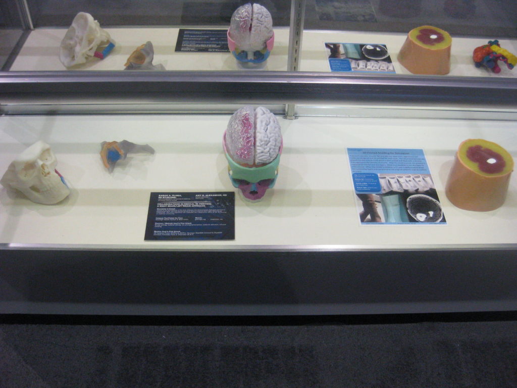 3D Printed Brain RSNA 2019