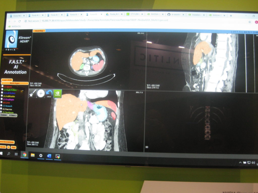 RSNA 2019 NVIDIA Clara Segmentation